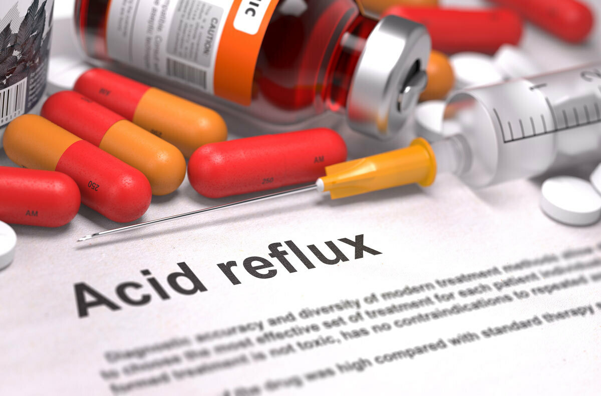 Acid Reflux – Treating It With Medication