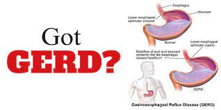 What cause acid reflux disease, its symptoms and treatments